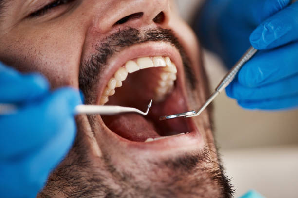 Best Full Mouth Reconstruction  in Longview, TX